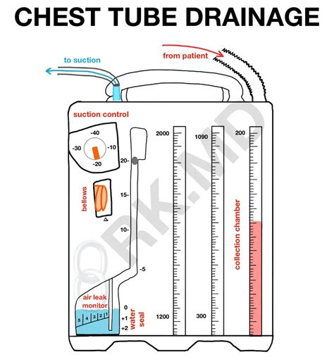 How Chest Tube Drainage Systems Work 